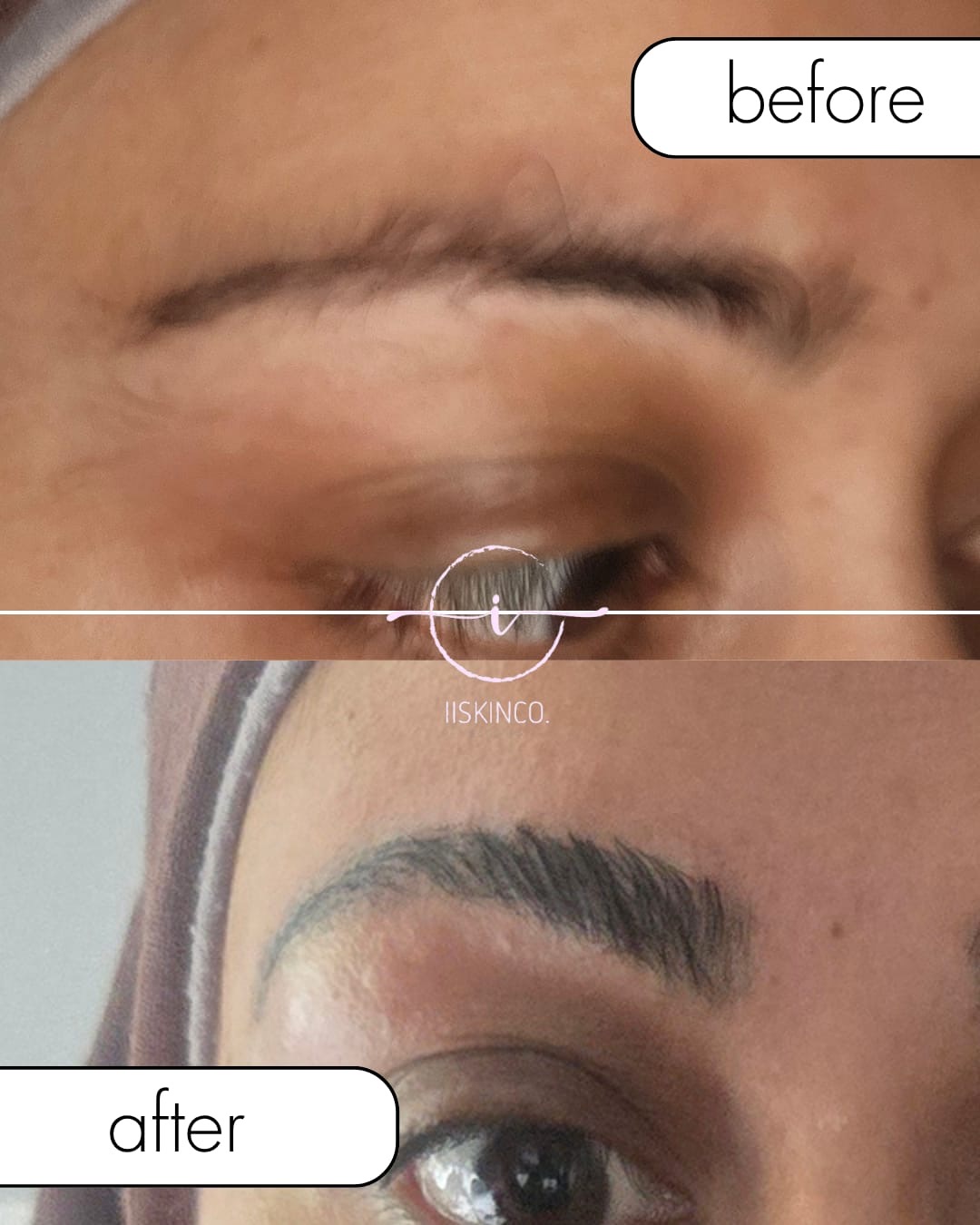 Before and after brow treatment, fuller defined brows